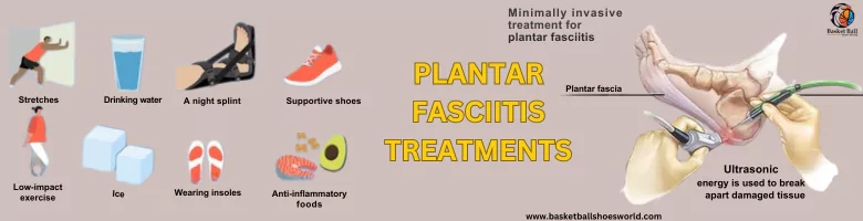 plantar-fasciitis-treatments